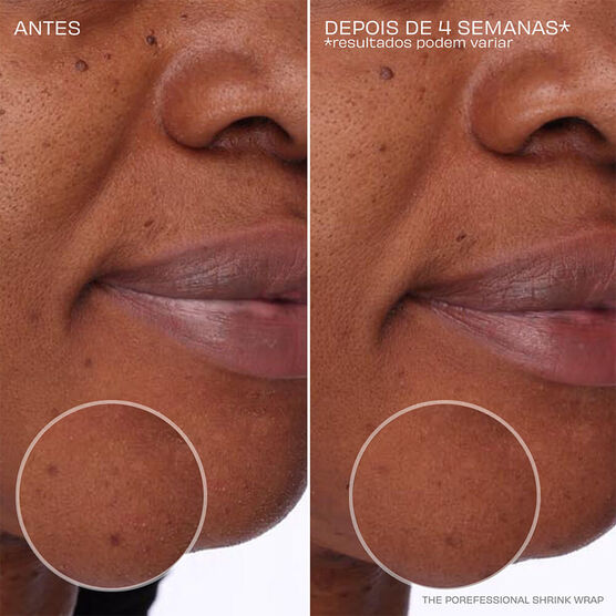 THE POREFESSIONAL OVERNIGHT TREATMENT